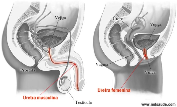 La Uretritis En Hombres Síntomas Causas Y Tratamientos 1820